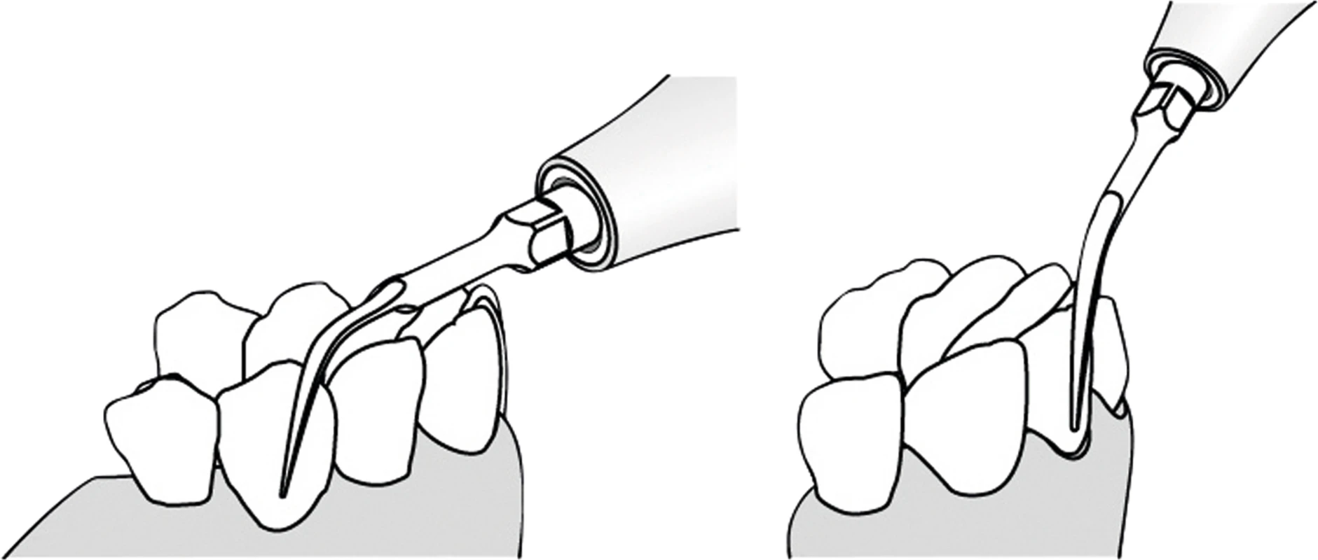 PIEZO Scaler Tip KaVo
